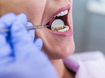 Η καλύτερη εμπειρία υγείας για τα δόντια.