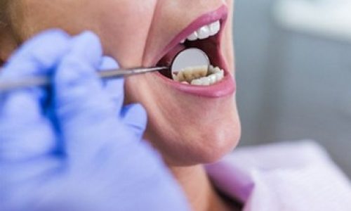 Η καλύτερη εμπειρία υγείας για τα δόντια.